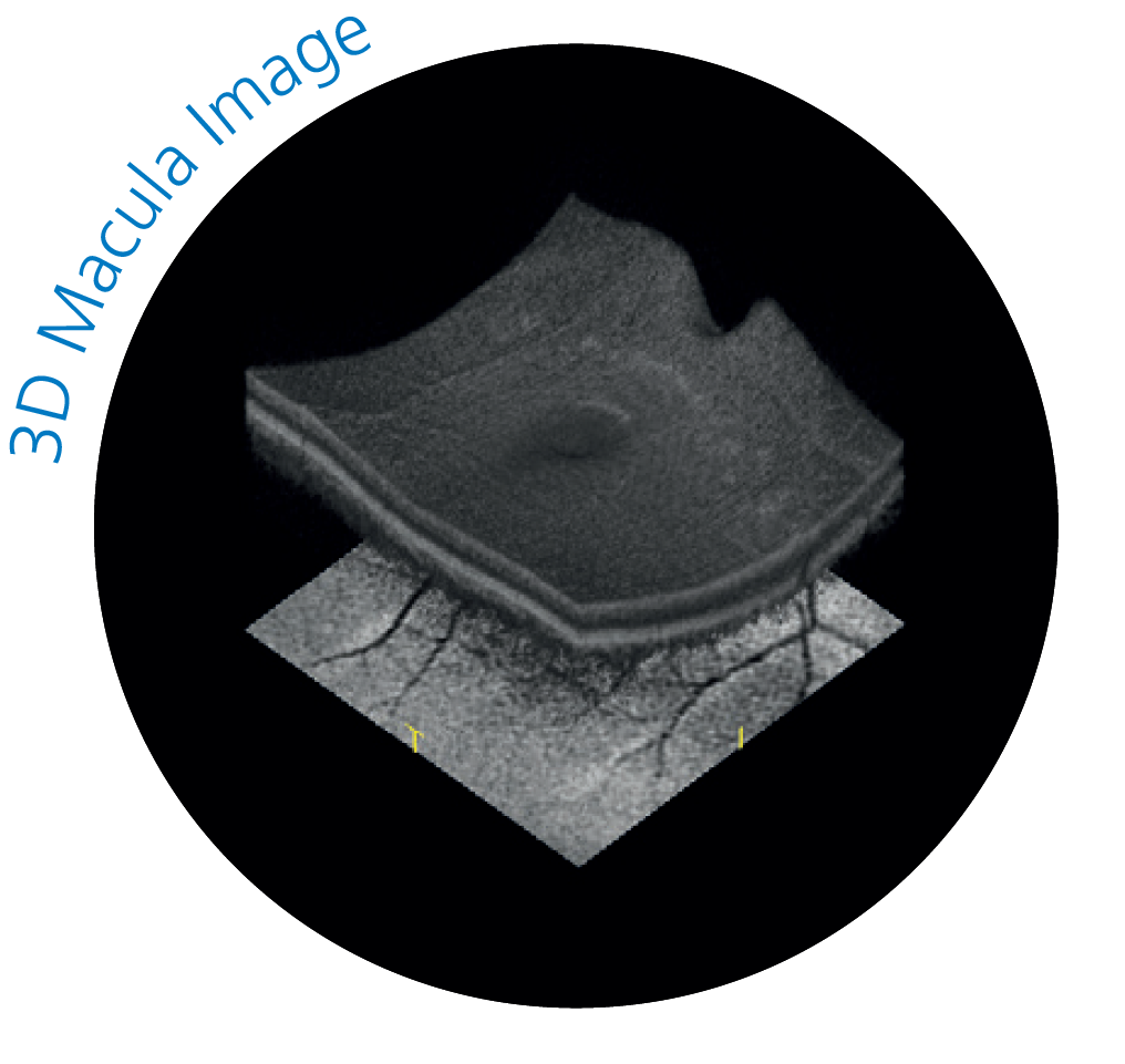 3D macula scan showing macular pigment density